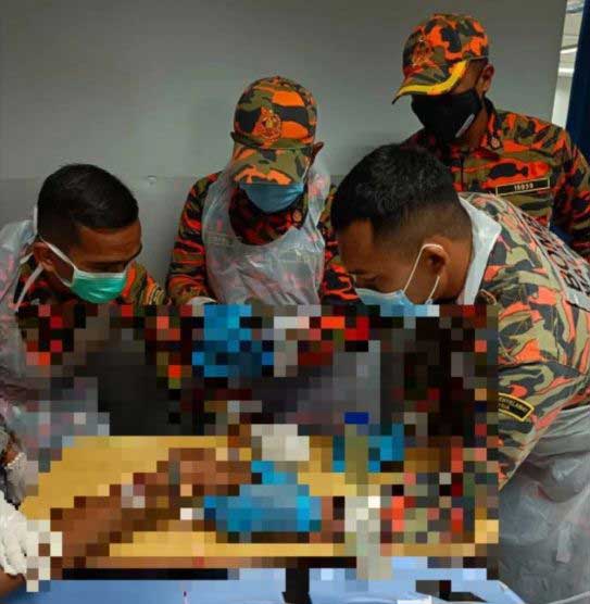 Man's metal nuts fingers being cut by firefighters