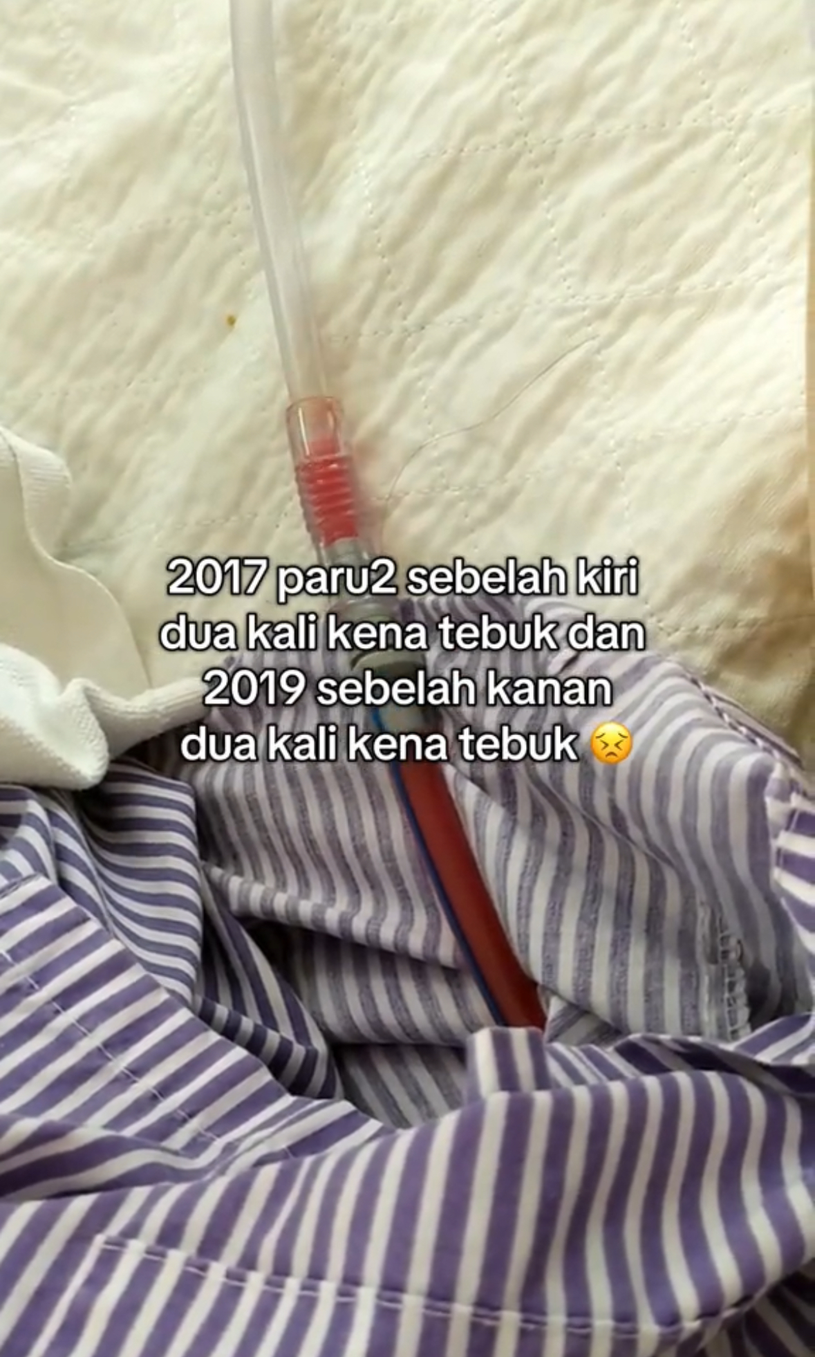 M’sian Woman Has Her Lungs Punctured 4 Times After Being A Passive Smoker